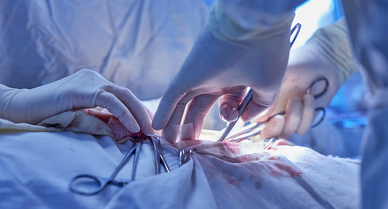 Carotid Stenting