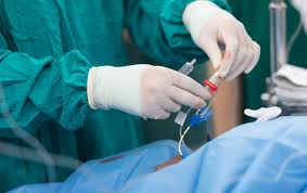 Orbital Atherectomy