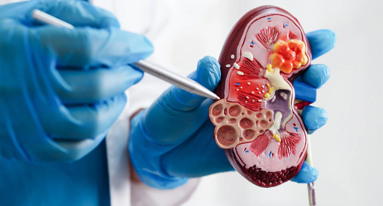 Renal Stenting